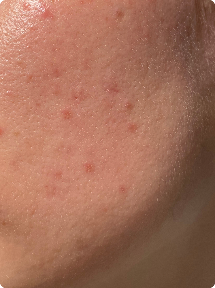 Rectangle-102-1 Rectangle-102-1