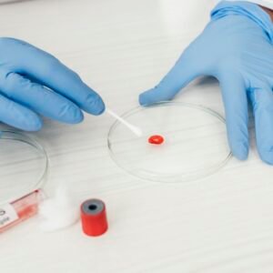 Kidney Function Test (KFT)
